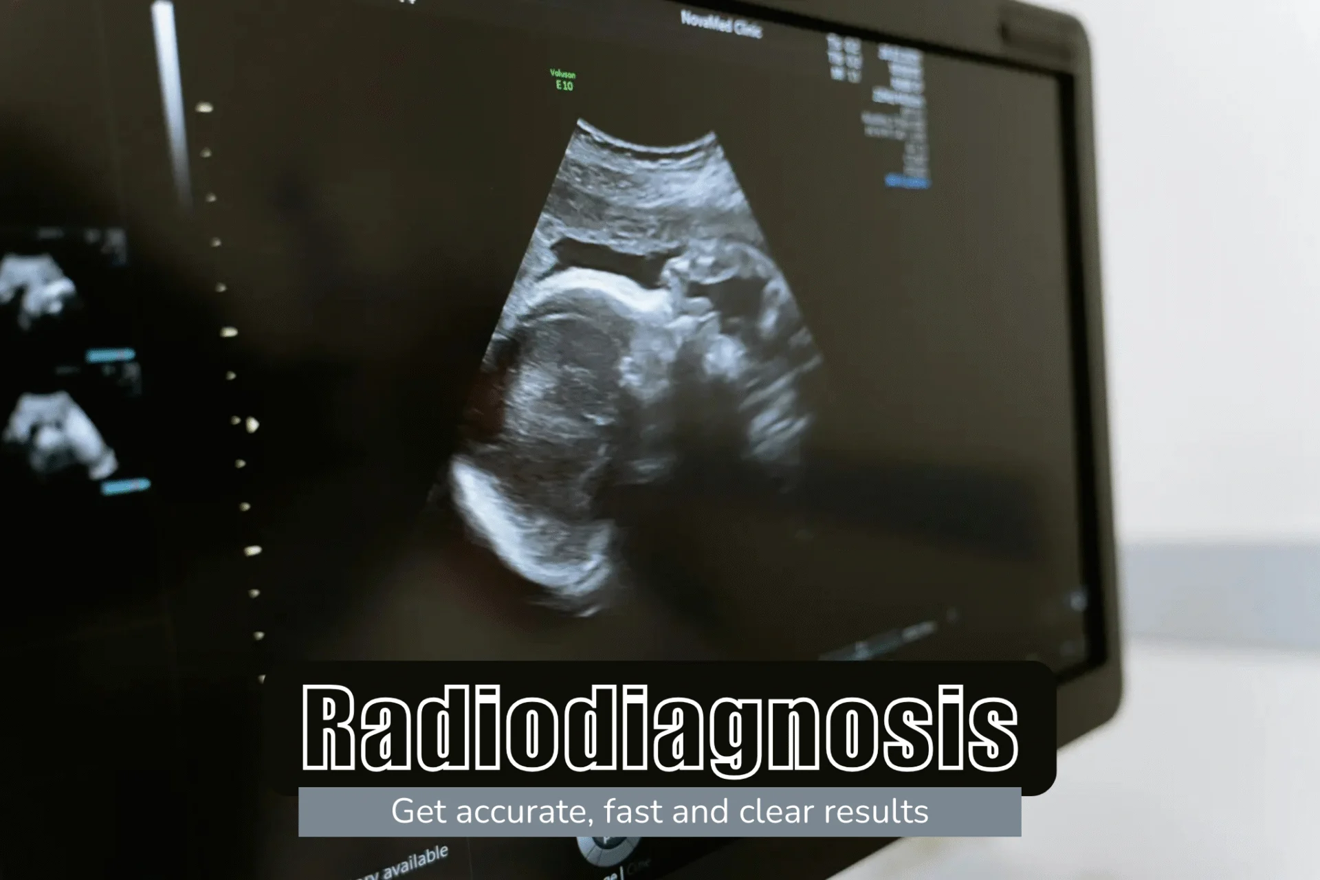 Radiodiagnosis In Moradabad